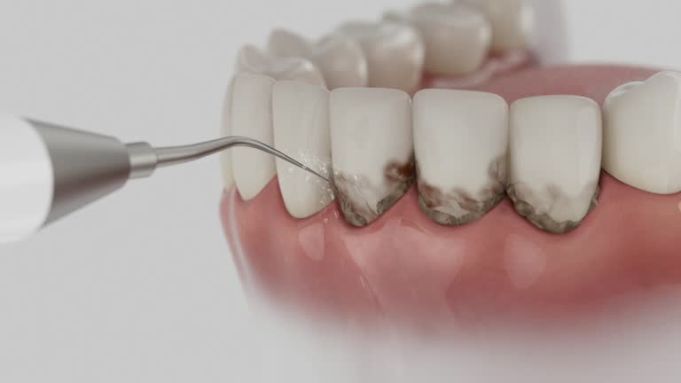 Trusted Teeth Cleaning And Checkup service in Granbury, TX - Dentist Open Now